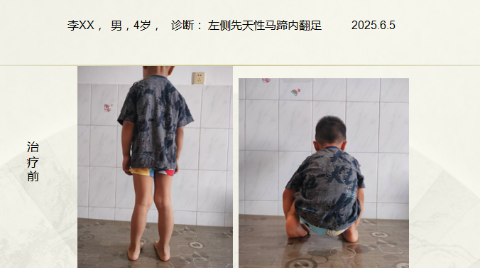 病例七十一