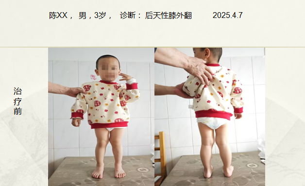 病例六十九