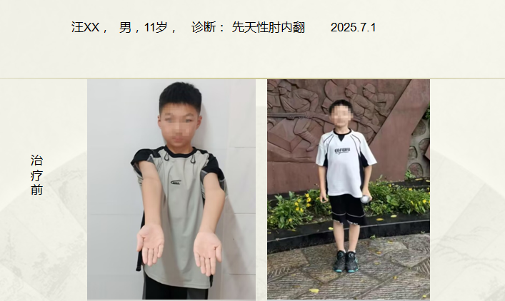 病例七十二