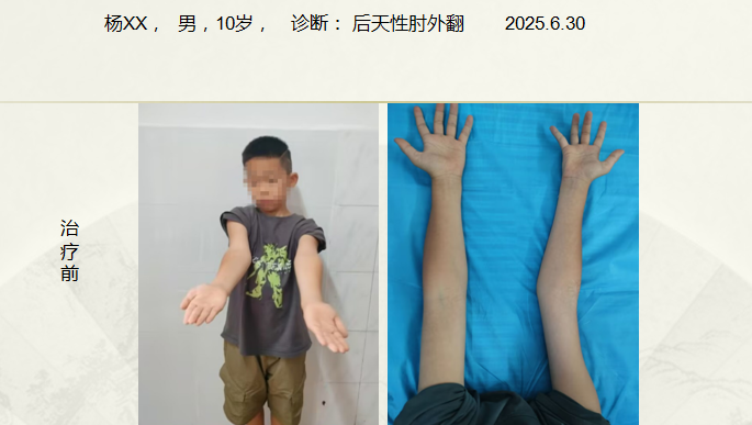 病例七十