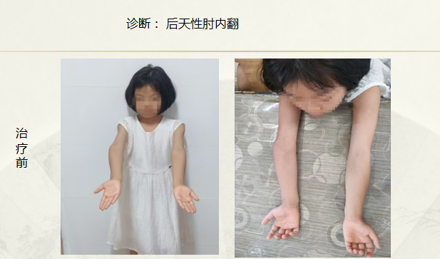 病例七十六