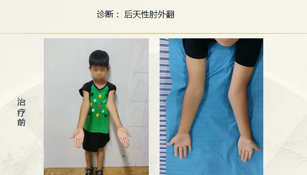 病例七十四