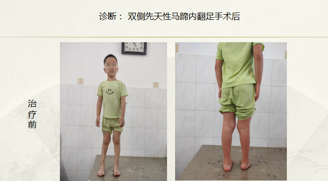 病例七十五