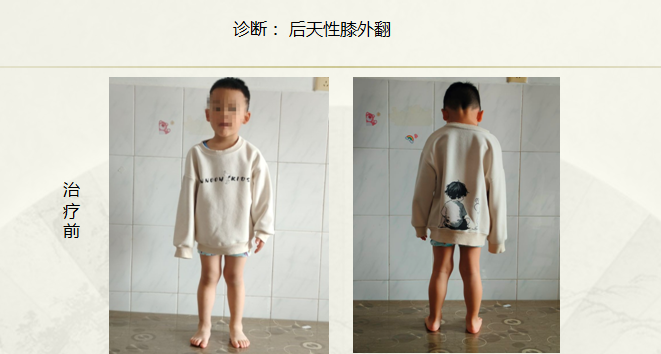 病例七十七