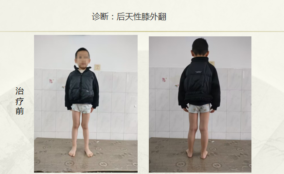 病例七十八