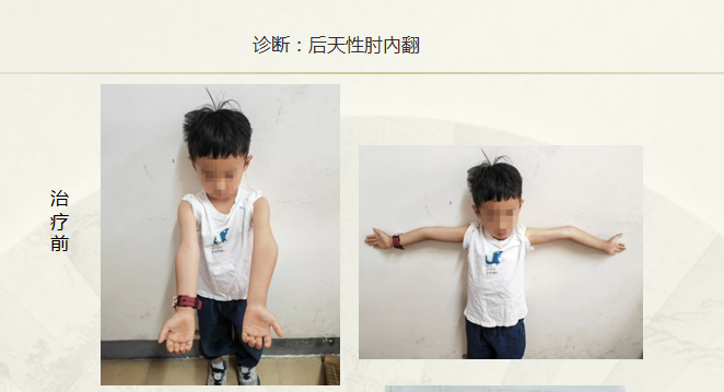 病例七十九