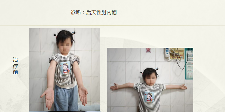 病例八十