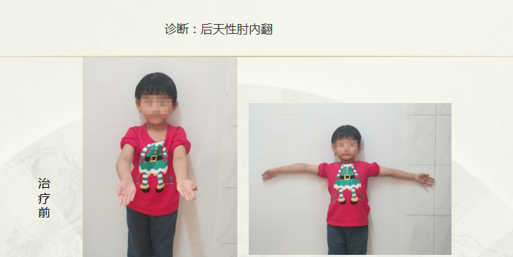 病例八十一