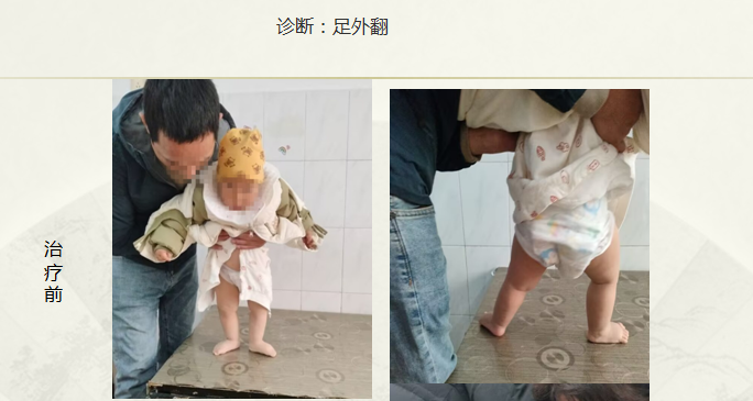 病例八十二